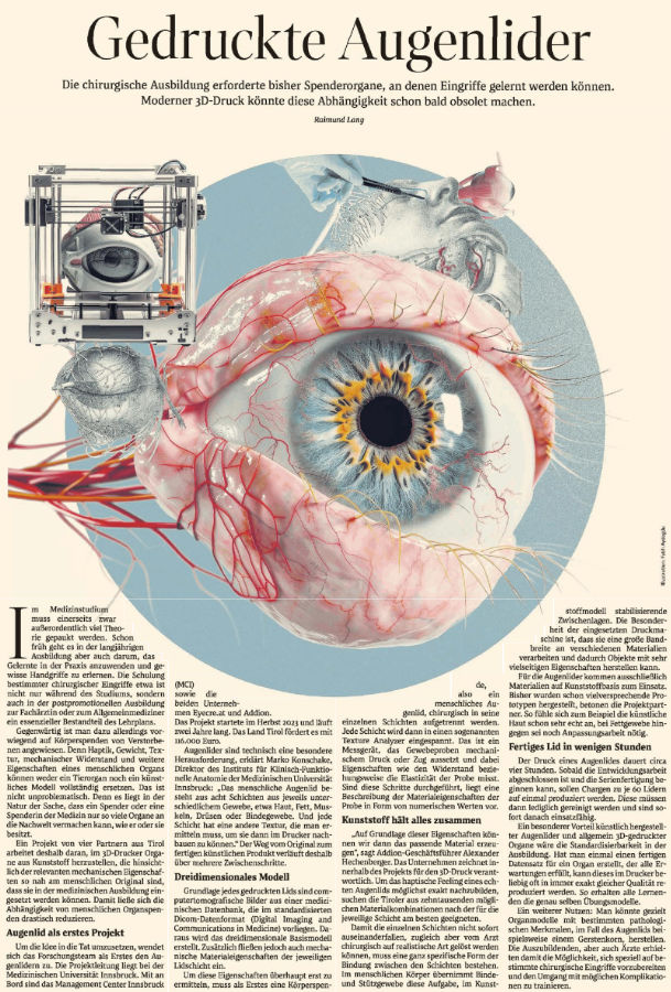 Der Standard berichtet in der Ausgabe vom 17. April 2024 über 3D gedruckte Augenlieder, ein Projekt das federführend vom Instituts für Klinisch-Funktionelle Anatomie und der Medizinischen Universität Innsbruck geleitet wird.