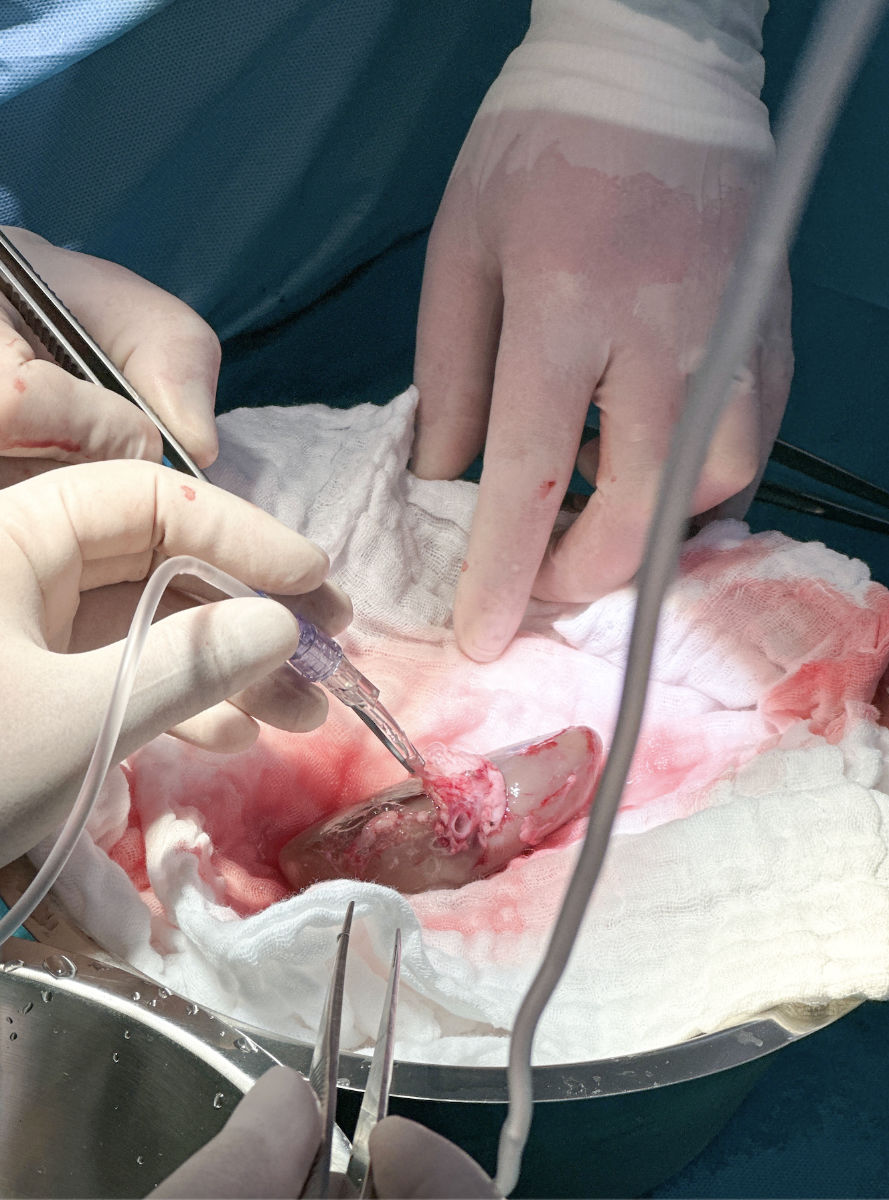 Vorbereitung der Schweinenniere mit der speziellen Flüssigkeit von X-Therma.