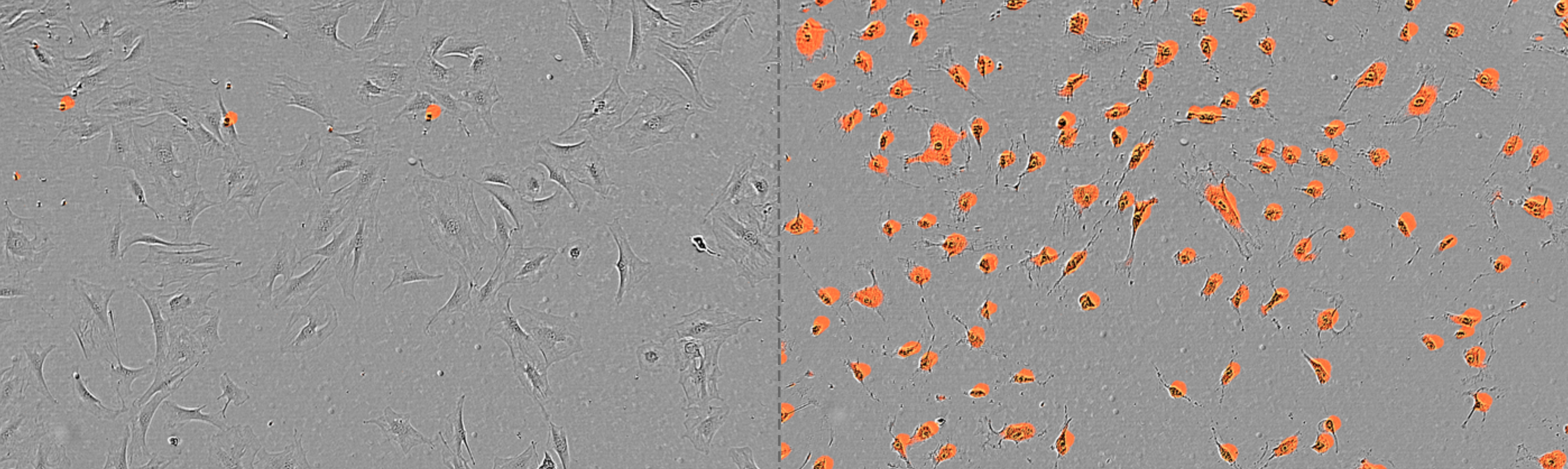 "Die Abbildung zeigt unbehandelte Grm1-positive Melanomzellen auf der linken Seite sowie rechts Zellen, die mit L-Buthionin-(S,R)-Sulfoximin (L-BSO), einem Inhibitor des Glutamatstoffwechselwegs, behandelt wurden. Die rote Fluoreszenz markiert sterbende oder tote Zellen. (Bild: Metabolic inhibition of glutamate-cysteine ligase increases dendritic cell-mediated antitumor immunity in melanoma. Journal for ImmunoTherapy of Cancer. 2026;14:e014808. https:\/\/doi.org\/10.1136\/jitc-2026-014808)"