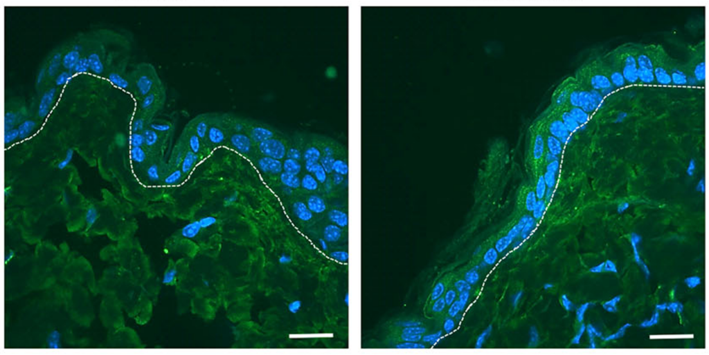 Die Aufnahmen zeigen eine verstärkte Immunofluoreszenzfärbung des antimikrobiellen Peptids mBD3 in PPARα-defizienter Haut (rechts) im Vergleich zur Kontrollhaut (links). Die erhöhte mBD3-Expression unterstreicht die Rolle von PPARα bei der Regulation der angeborenen Immunantwort der Haut. (Bild: Cell, Death & Disease/Univ.-Klinik für Dermatologie, Allergologie und Venerologie, Innsbruck)