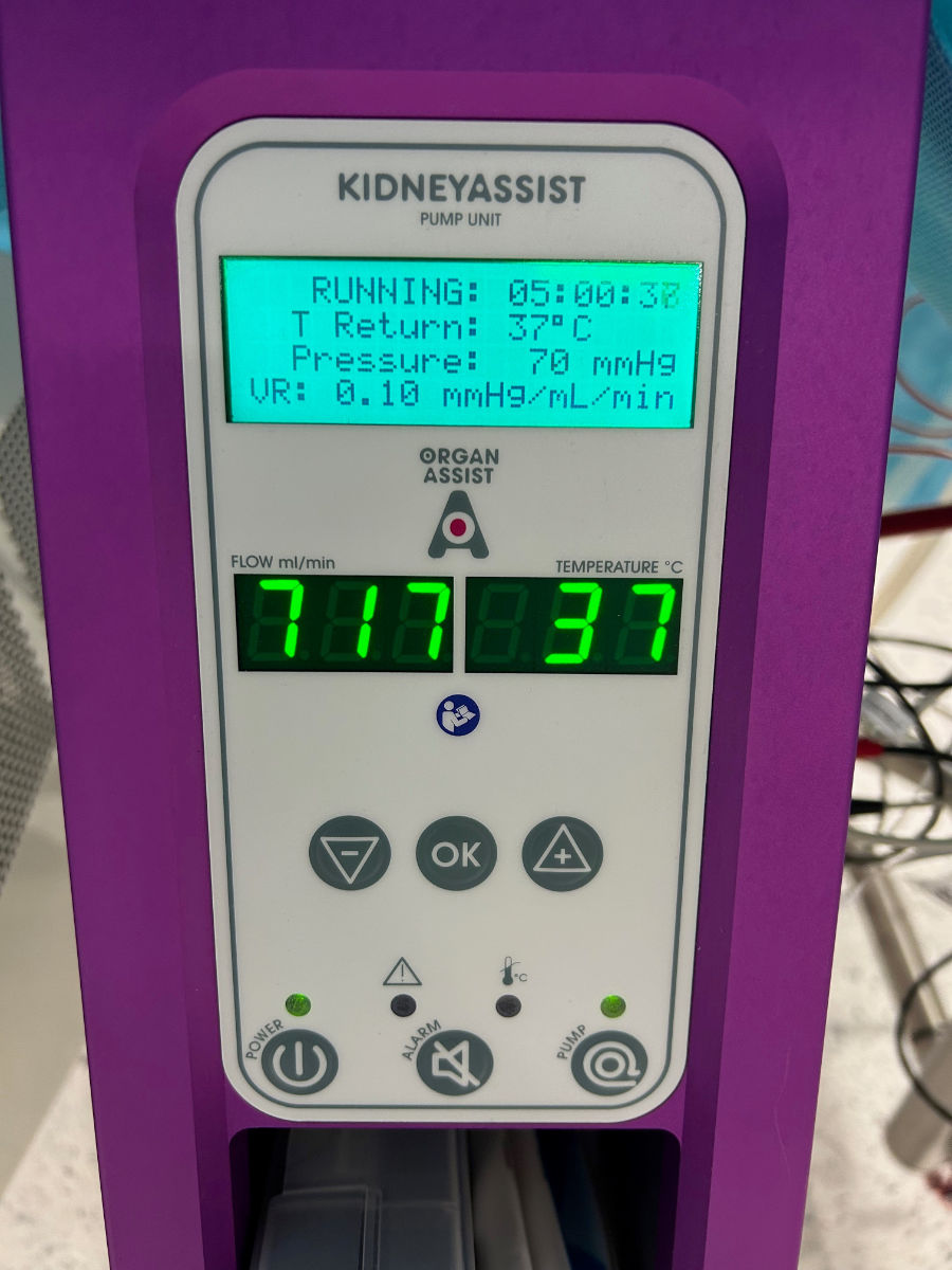 Abbildung der Steuereinheit des Perfusions-Systems.